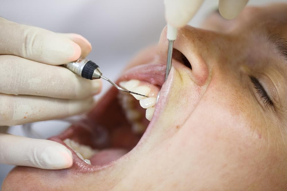 Periodoncia: como previr e tratar as enfermidades das encías