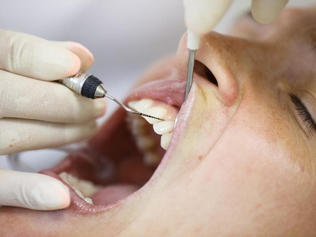 Periodoncia: como previr e tratar as enfermidades das encías