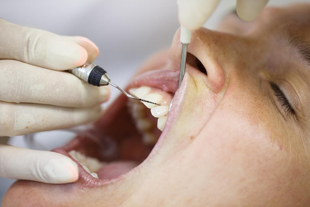 Periodoncia: cómo prevenir y tratar las enfermedades de las encías