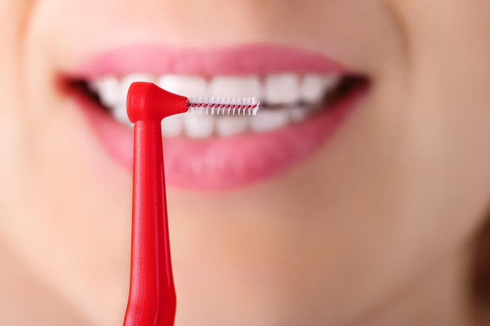 ¿Qué es el cepillado interdental y cómo se realiza?