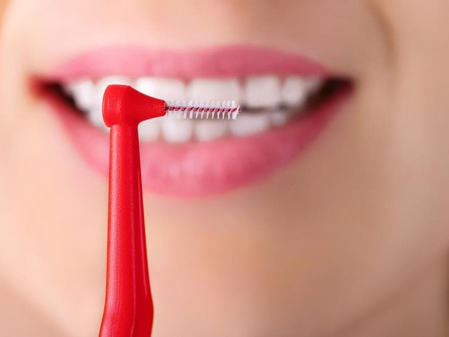 ¿Qué es el cepillado interdental y cómo se realiza?