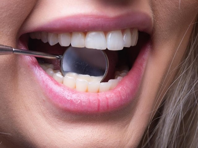 ¿Qué es la ortodoncia lingual?