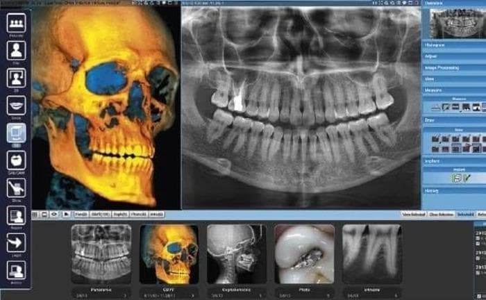 ¿Qué es un TAC Digital Dental Radiodiagnóstico 3D (Escáner CBCT) y cómo puede ayudar en los tratamientos odontológicos?